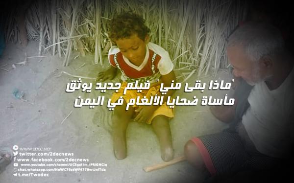 "ماذا بقى مني"  فيلم جديد يوثق مأساة ضحايا الألغام في اليمن