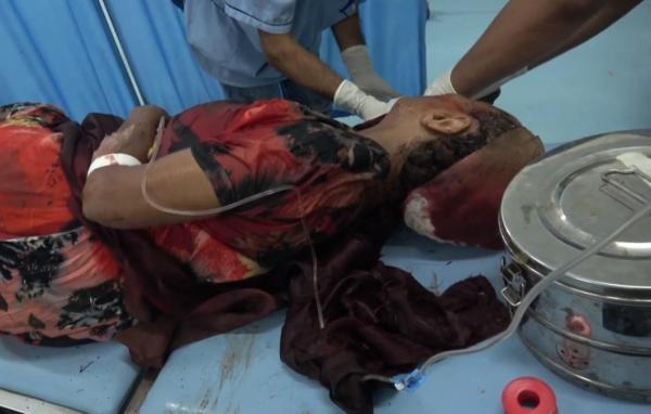 التحالف: 19 شهيدا وجريحا من المدنيين بنيران مليشيات الحوثي في الحديدة خلال 24 ساعة الماضية