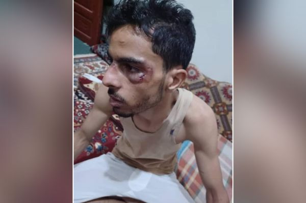 مليشيا الحوثي تعتدي على شاب في إب حاول تقديم وجبة إفطار لسُجناء المركزي