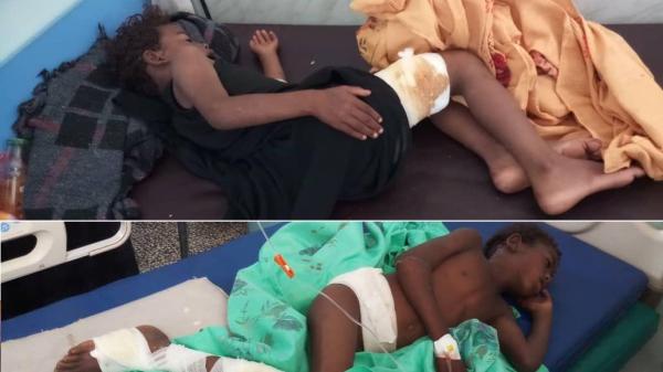 استشهاد وإصابة ثلاثة أطفال في قصف حوثي بالضالع 