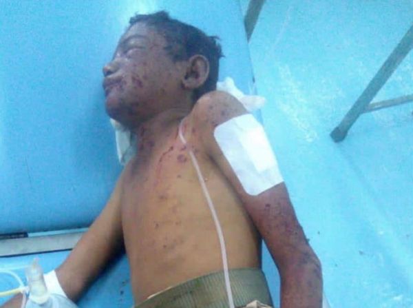 تقرير| 400 حالة وفاة خلال فترة الهدنة.. ومليشيا الحوثي تصعِّد أعمال العنف السياسي 