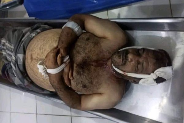 تعز.. استشهاد مواطن برصاص قناص حوثي في اول أيام العيد