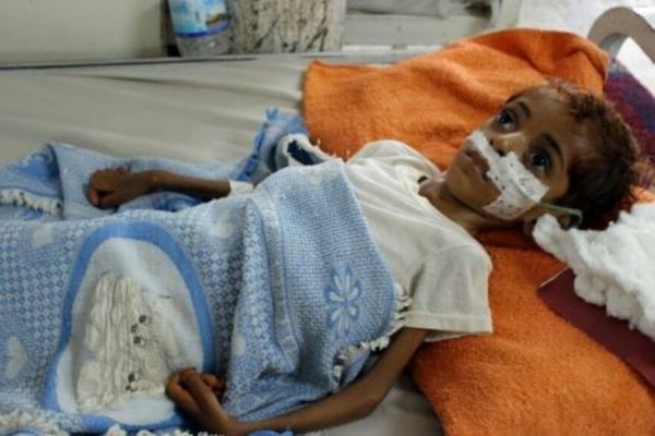 بالتعاون مع مركز الملك سلمان.. الصحة العالمية تعلن دعم وحدات طب الأطفال في 8 مستشفيات يمنية