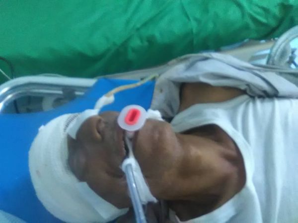 إصابة مواطن برصاص قناص حوثي في حيس