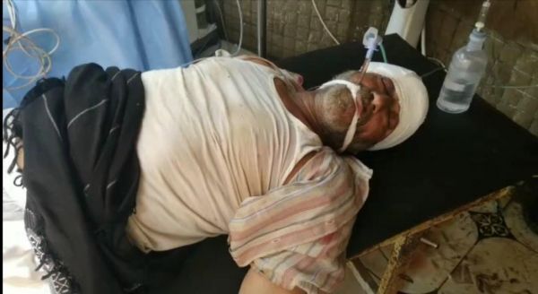 الثالثة خلال أيام.. إصابة خطيرة لمواطن برصاصة قناص حوثي شرق مدينة الحديدة