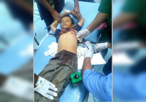 حيس.. قناص حوثي يصيب طفلاً نازحاً أثناء لعبه في حي المغل 