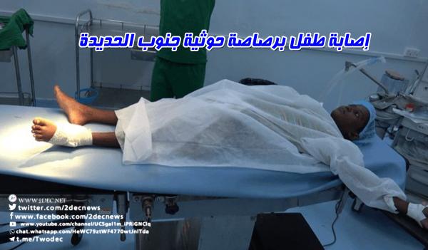 إصابة طفل برصاصة حوثية جنوب الحديدة