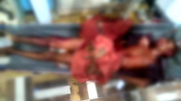 استشهاد اثنين وإصابة ثالث من المدنيين في قصف مدفعي حوثي بحيس