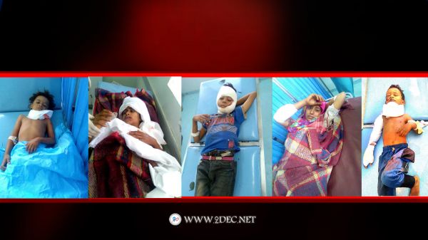 مستشفى الخوخة يستقبل نساء وأطفال من ضحايا جريمة الحوثي بالدريهمي