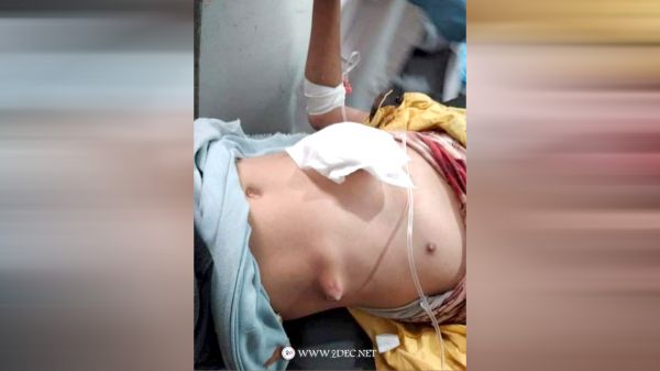 حصيلة أولية: استشهاد طفلين وإصابة 3 مدنيين في مجزرة للحوثيين بتعز 