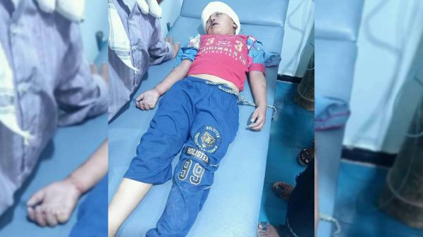 استشهاد طفل في قصف حوثي استهدف شمال مدينة تعز
