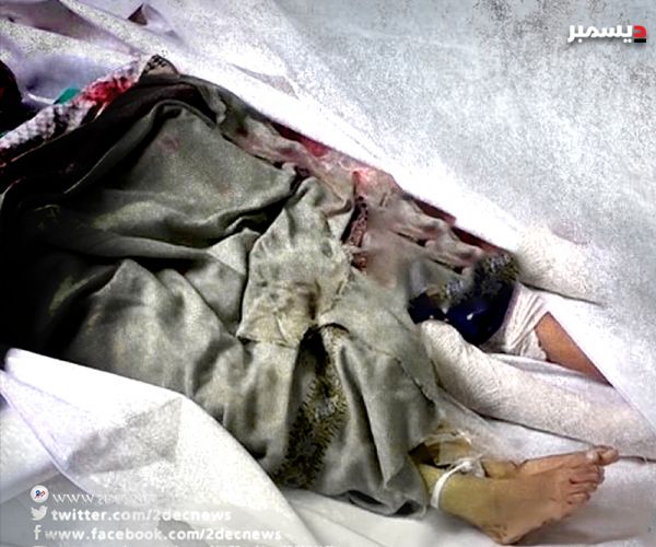 منظمة حقوقية: قرابة 3600 قتيل وجريح بنيران الحوثيين في تعز 