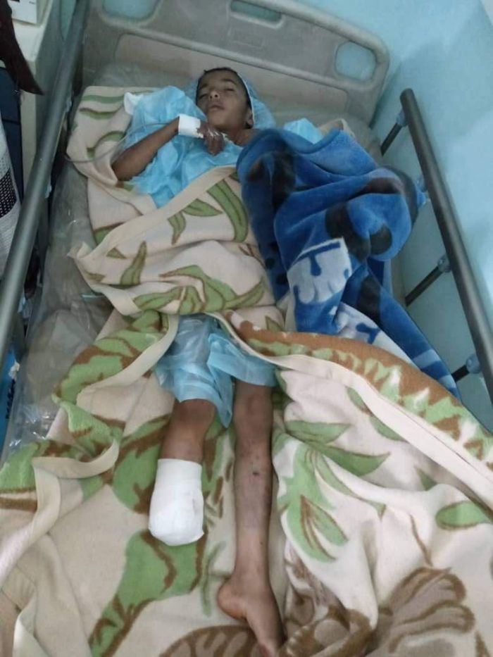 لغم حوثي يبتر قدم طفل في البيضاء