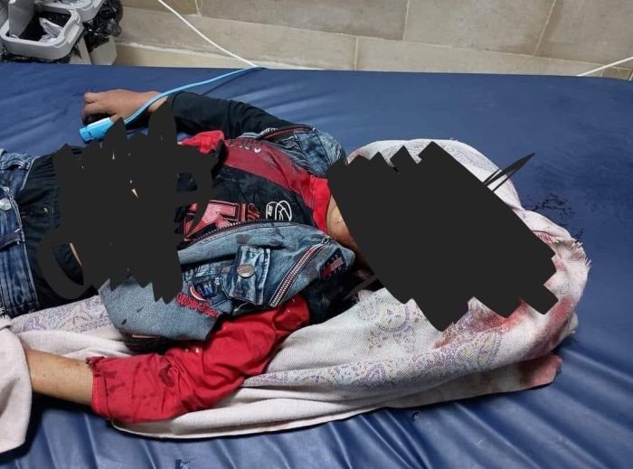مقتل طفل برصاص مسلحين في إب