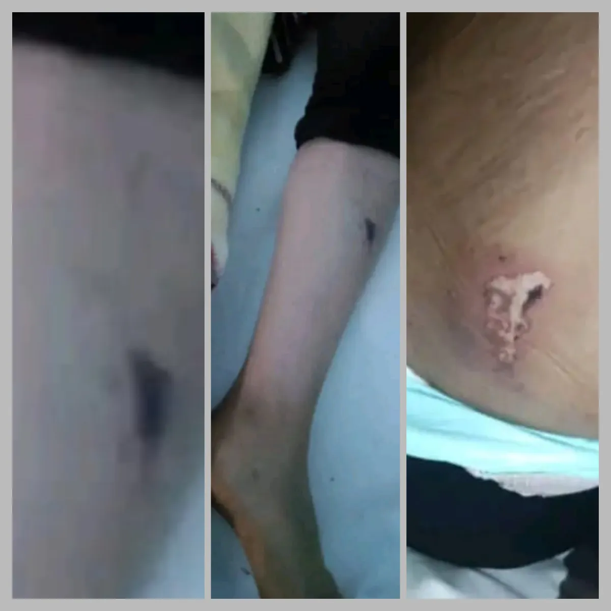 تعز.. العثور على طفلة في شرعب بعد يومين من اختفائها في ظروف غامضة