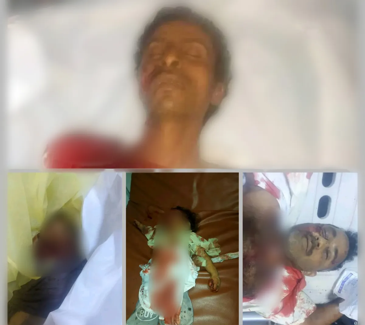 وزارة حقوق الإنسان: استهداف تجمع مدني في حيران حجة جريمة حوثية متعمدة