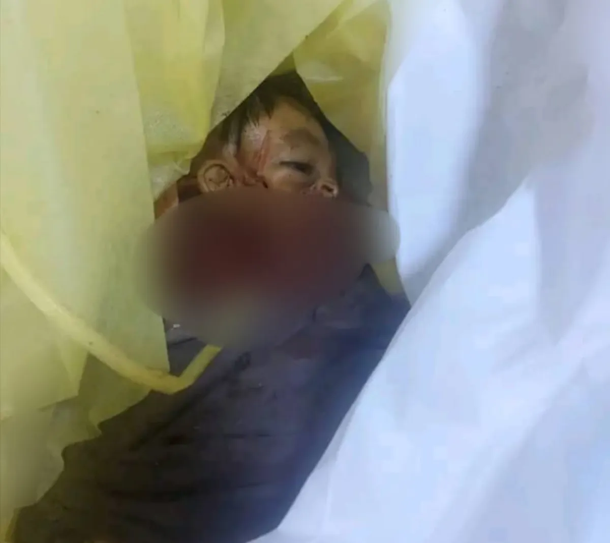 وزير الإعلام يدين المجزرة الحوثية بحق المدنيين في حجة ويطالب المجتمع الدولي بالتحرك