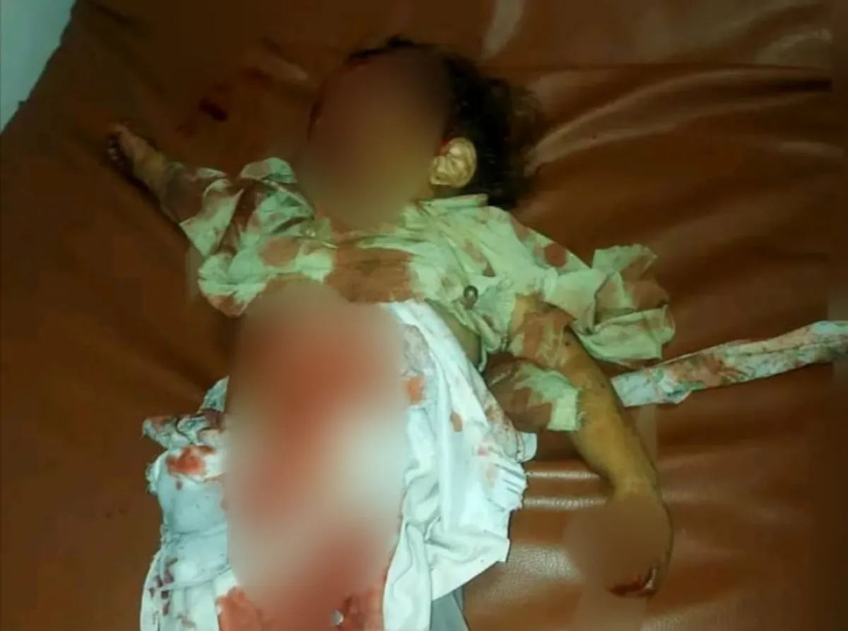 ارتفاع ضحايا قصف الحوثيين في حيران حجة إلى أكثر من 30 مدنيًا بينهم 3 أطفال.. والقصف مستمر