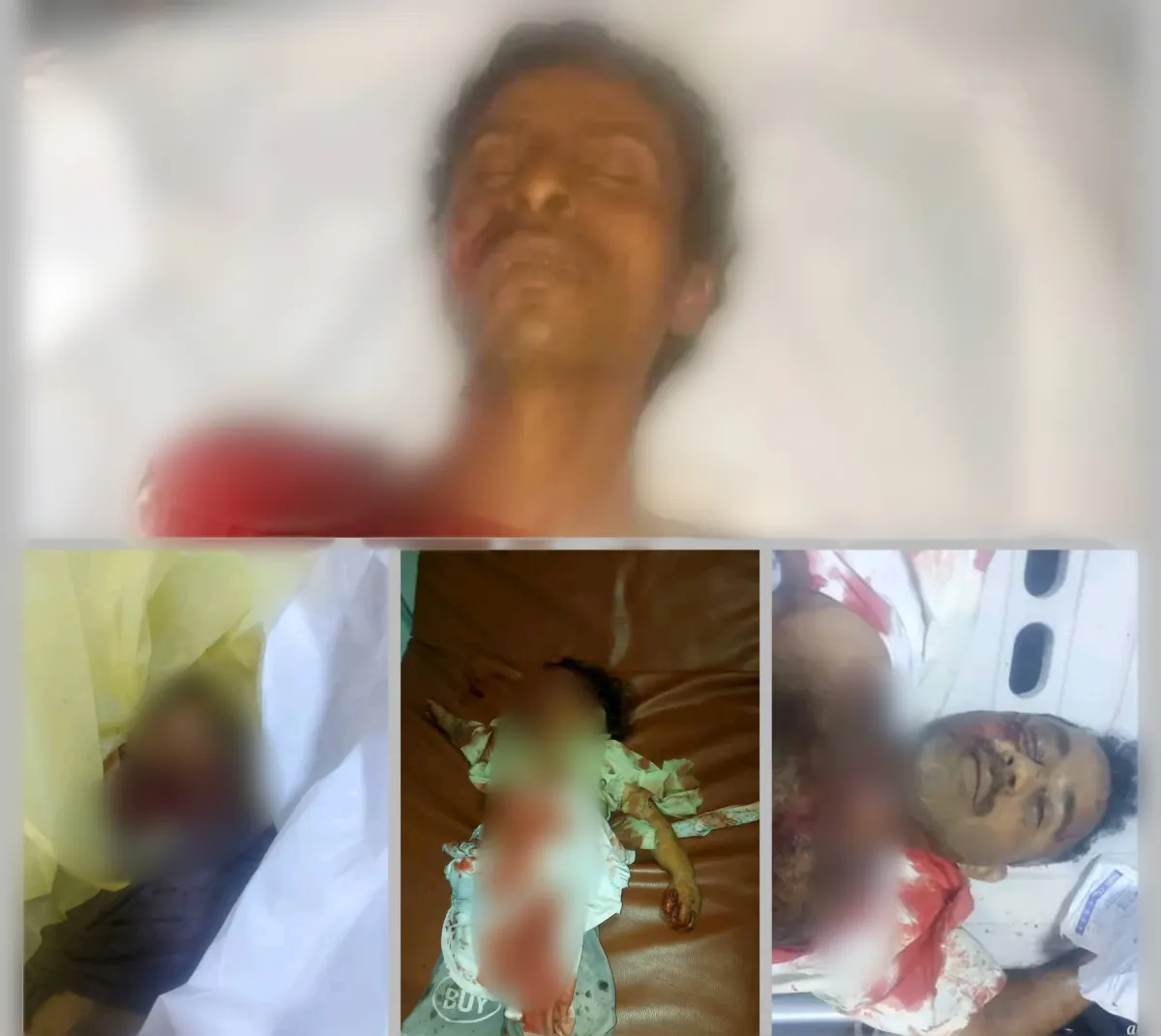 مطالب حقوقية بفتح تحقيق دولي في جريمة القصف الحوثي لأبناء حيران حجة