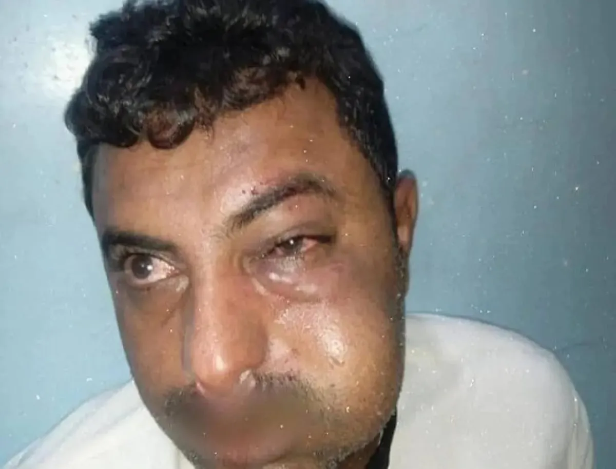 قيادي حوثي يعتدي على محامي في مدينة زبيد جنوب الحديدة