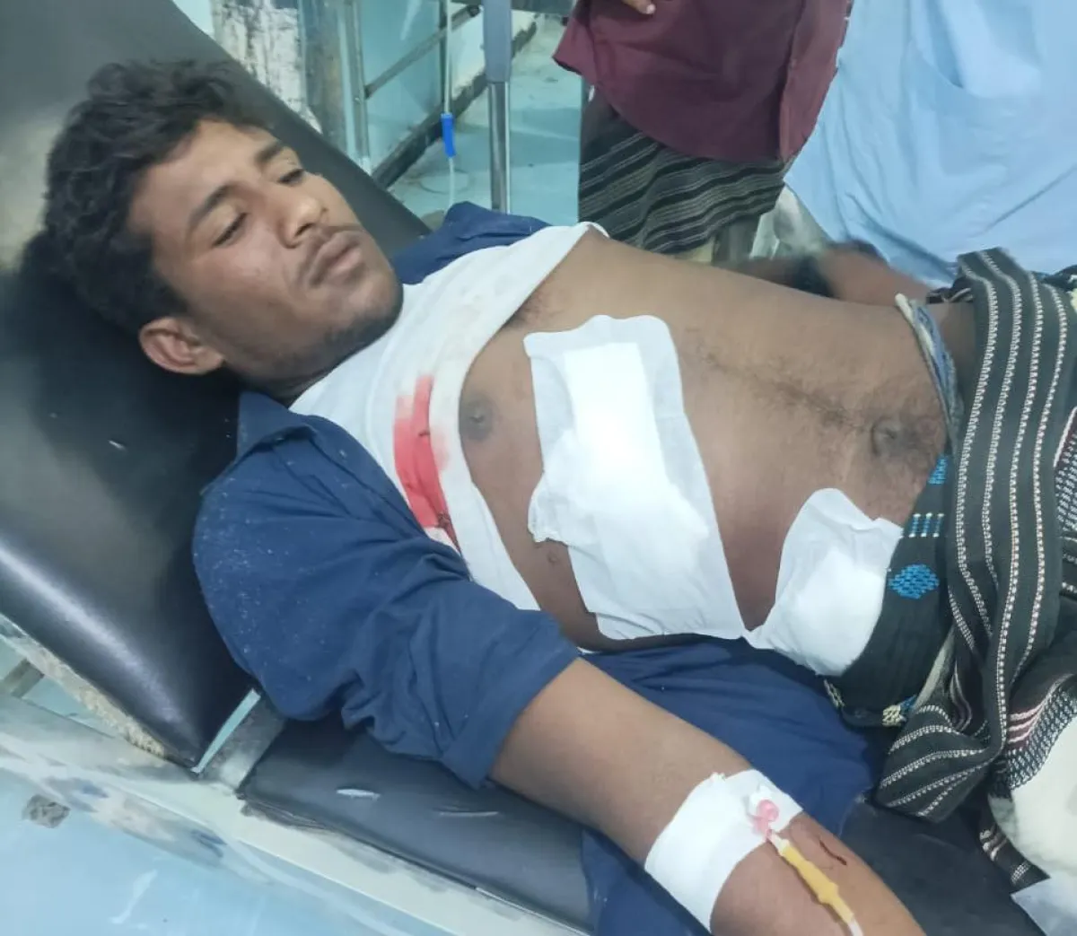 إصابة مواطن بقصف مدفعي حوثي على مخيم للنازحين جنوب الحديدة