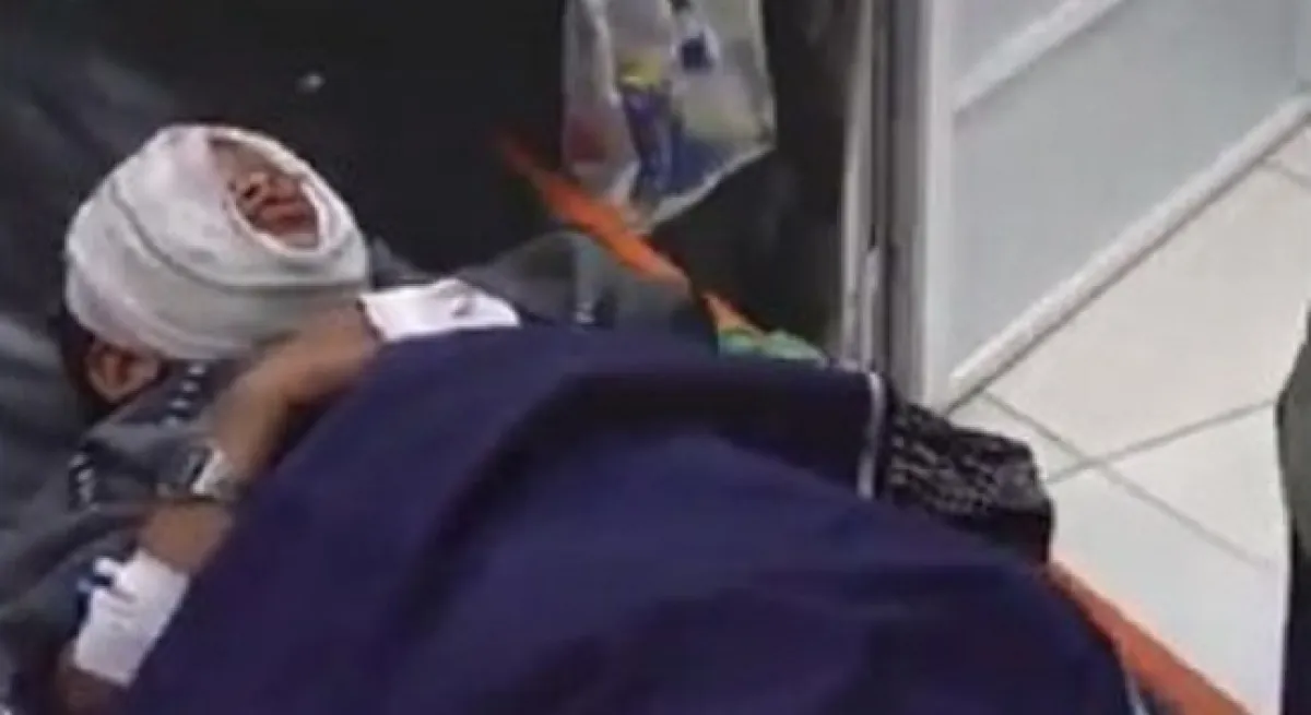 تعز.. إصابة طفل بمقذوف حوثي بعد يومين من استشهاد آخر