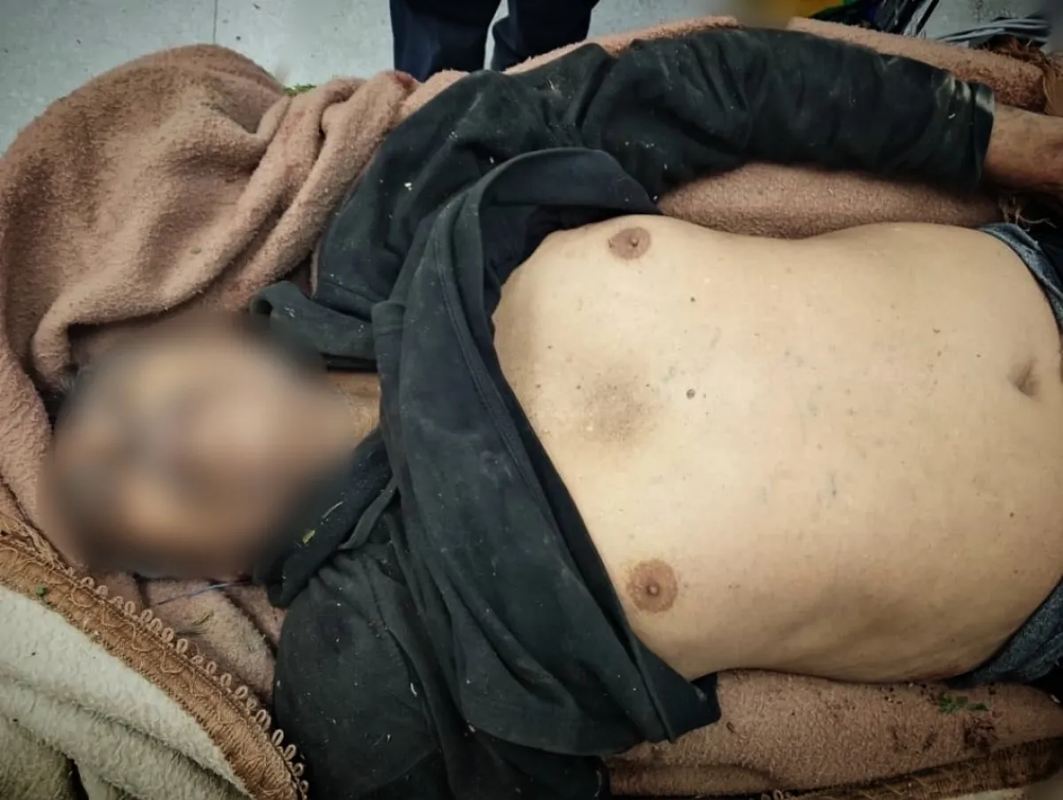 تعز.. استشهاد مُسن برصاص قناصة مليشيا الحوثي في جريمة جديدة