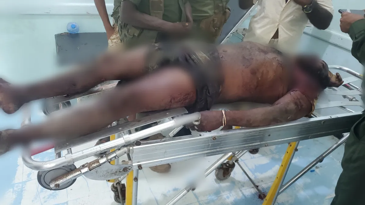 الحديدة.. مقذوف من مخلفات مليشيا الحوثي يودي بحياة مواطن في مديرية الخوخة