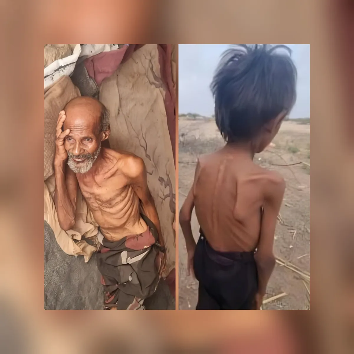 الجوع يودي بحياة مُسن وطفل داخل مخيمات النزوح في عبس حجة