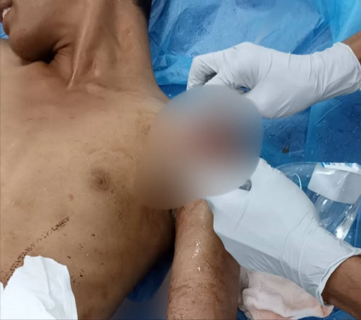 لحج.. إصابة شاب إثر قصف حوثي استهدف منازل المدنيين في مديرية المسيمير