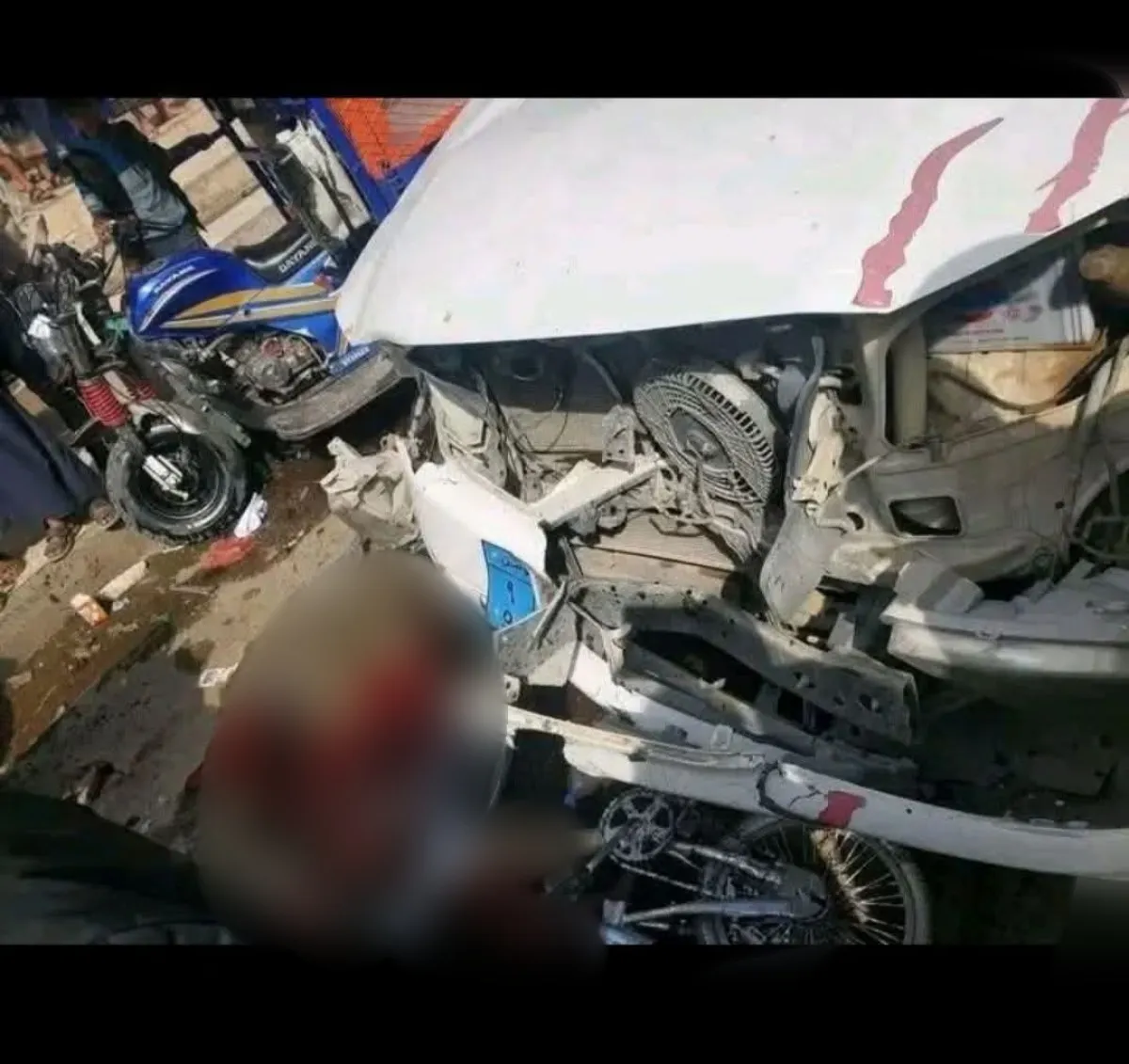 وفاة طفل وإصابة خمسة آخرين في حادث دهس بمدينة ذمار