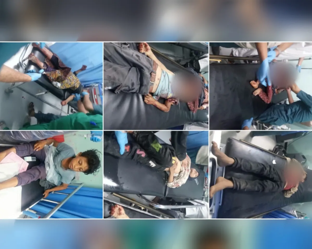 13 طفلًا بين شهيد وجريح بانفجار مقذوف من مخلفات مليشيا الحوثي في الضالع