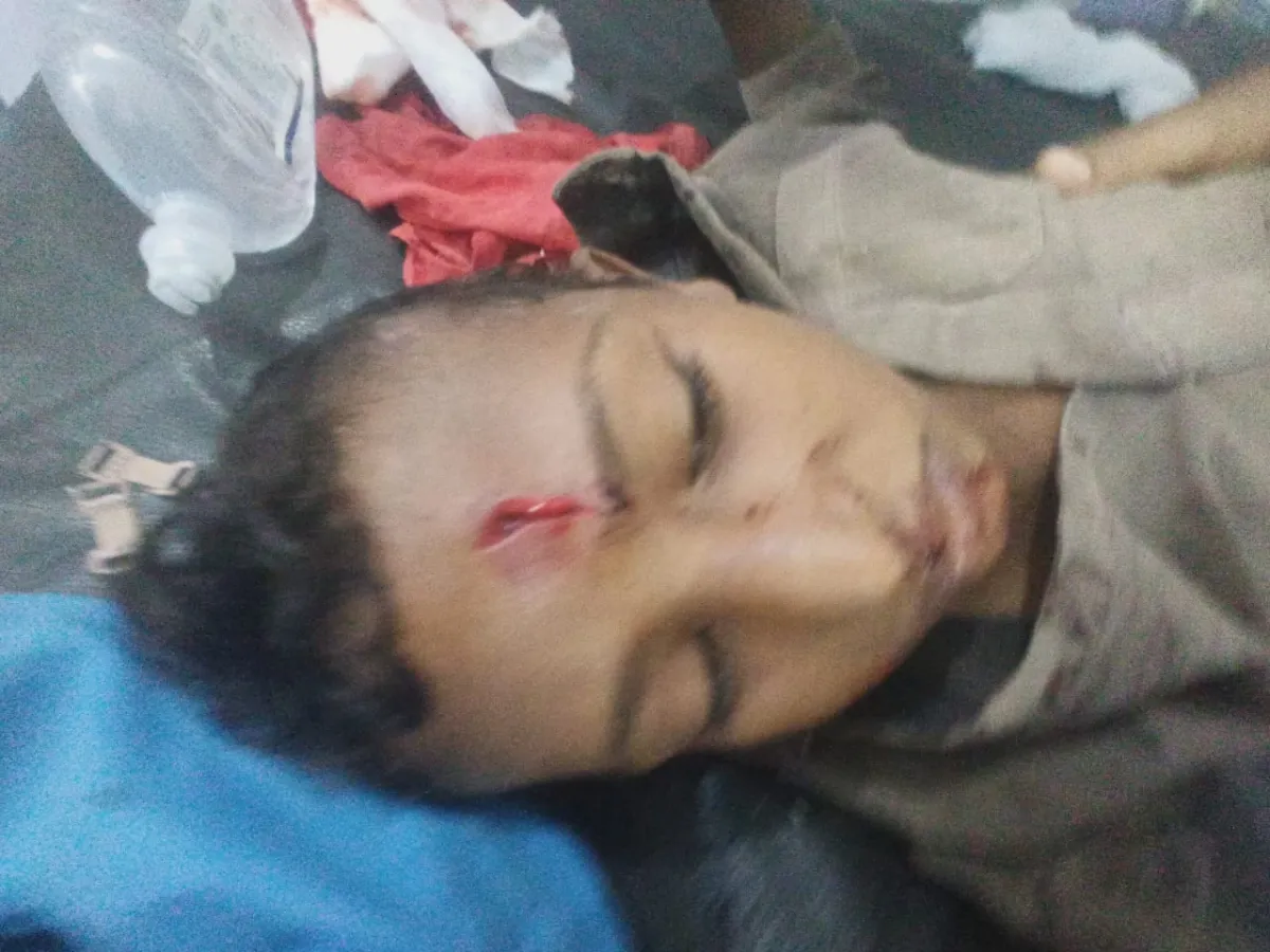 إصابة طفل بانفجار مقذوف من مخلفات مليشيا الحوثي جنوبي الحديدة