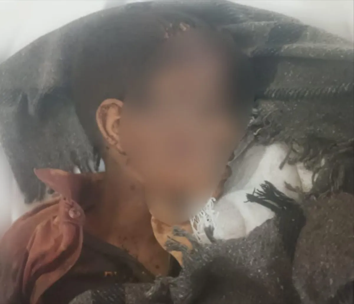 استشهاد طفل بقصف حوثي على منطقة سكنية شمال لحج