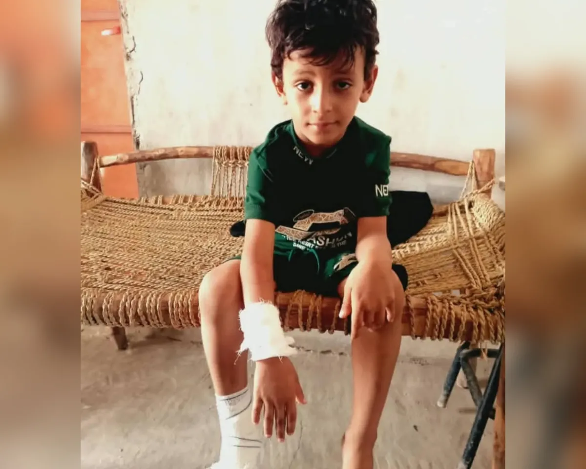 إصابة طفل في اعتداء حوثي بمسيرة على حي سكني في حيس