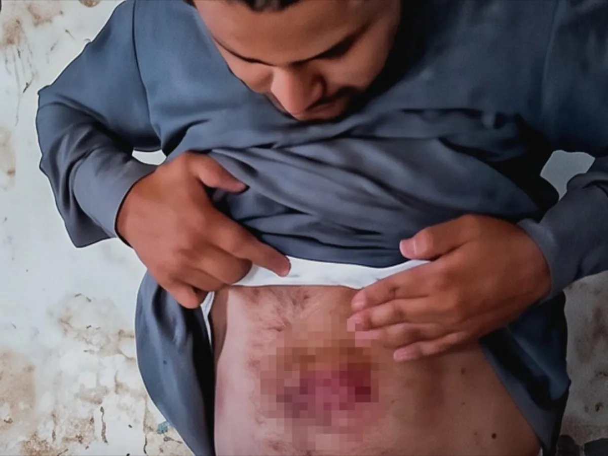 تعذيب مواطن في سجن حوثي بصعدة بعد احتجازه والاستيلاء على سيارته وسلاحه