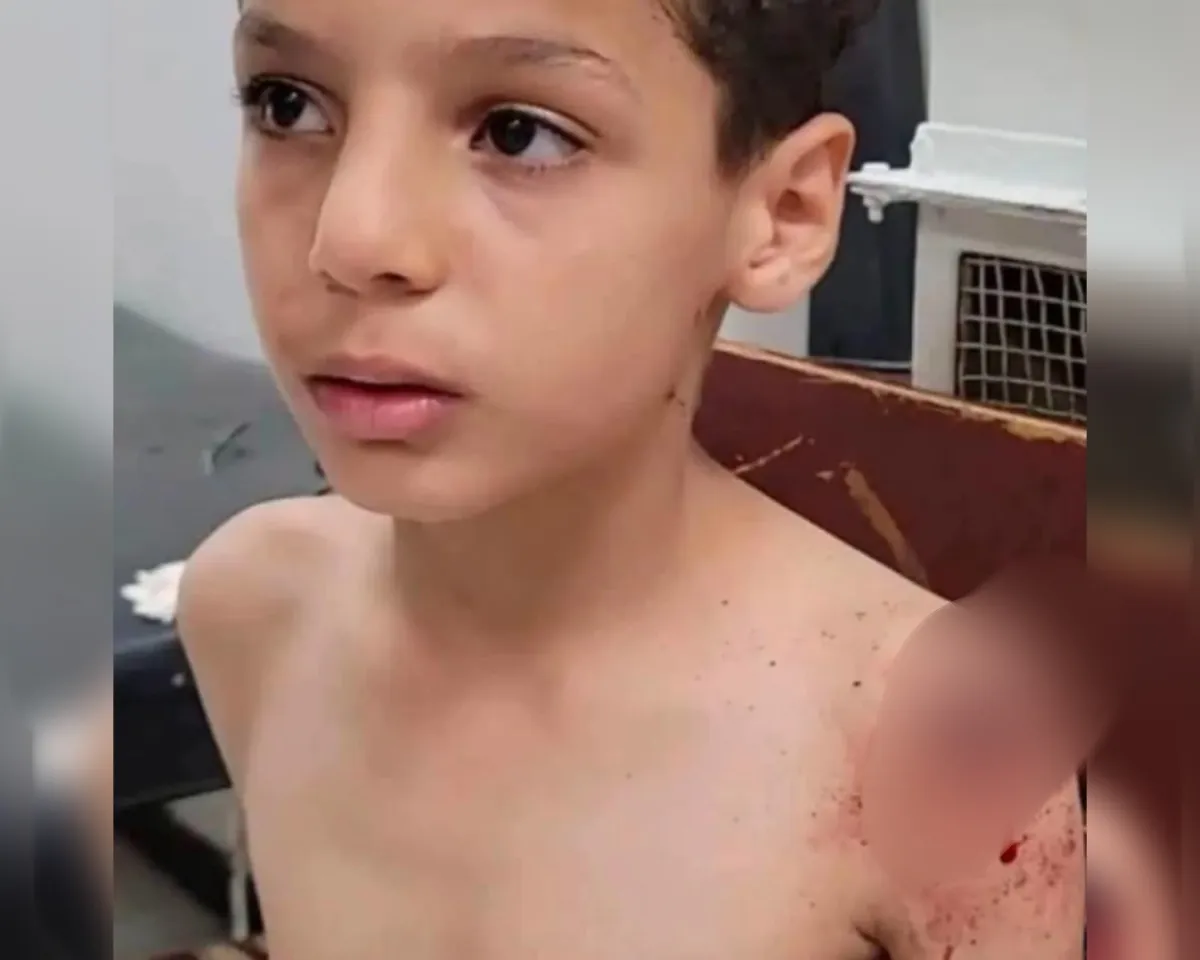 إصابة طفل بقصف حوثي استهدف حيًا سكنيًا في تعز