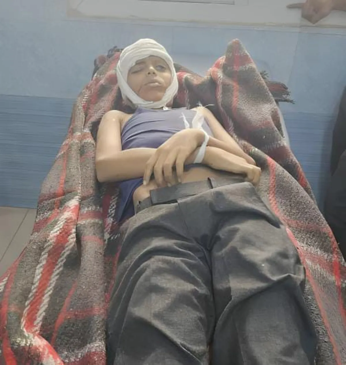 استشهاد طفل وإصابة ستة مدنيين بقصف لمليشيا الحوثي استهدف منزلًا شرقي مدينة تعز