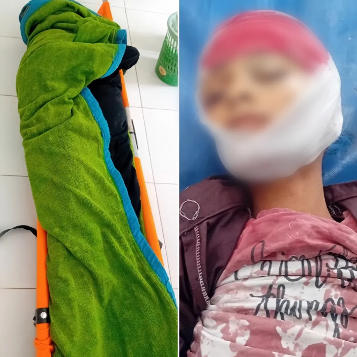 تعز.. استشهاد امرأة وطفل وإصابة 6 آخرين بقصف حوثي على منطقة الشقب