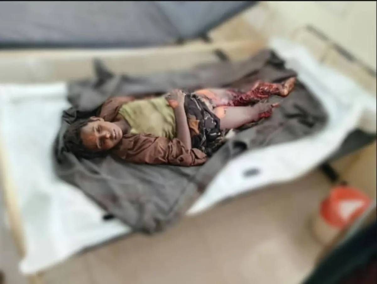 لغم حوثي يودي بحياة طفل في مديرية الجراحي بالحديدة