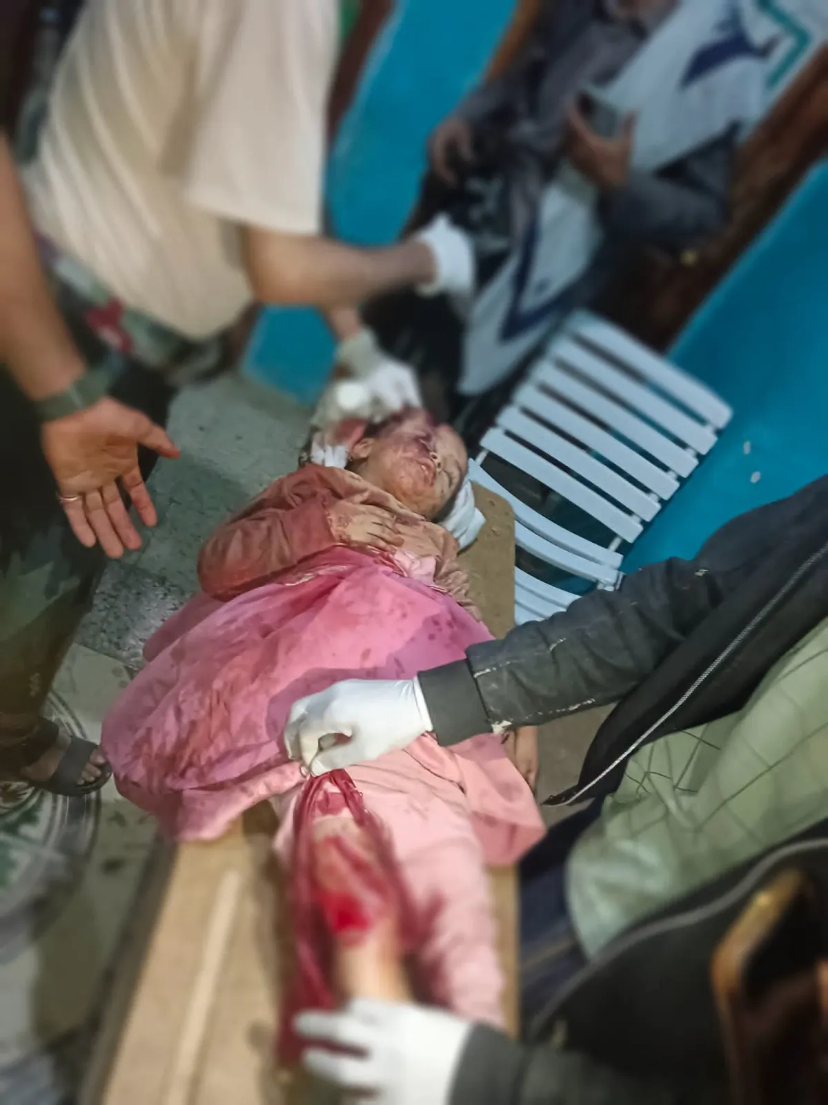 تعز.. استشهاد مدني وإصابة طفلة وامرأة جراء قنص وقصف حوثي في صبر الموادم
