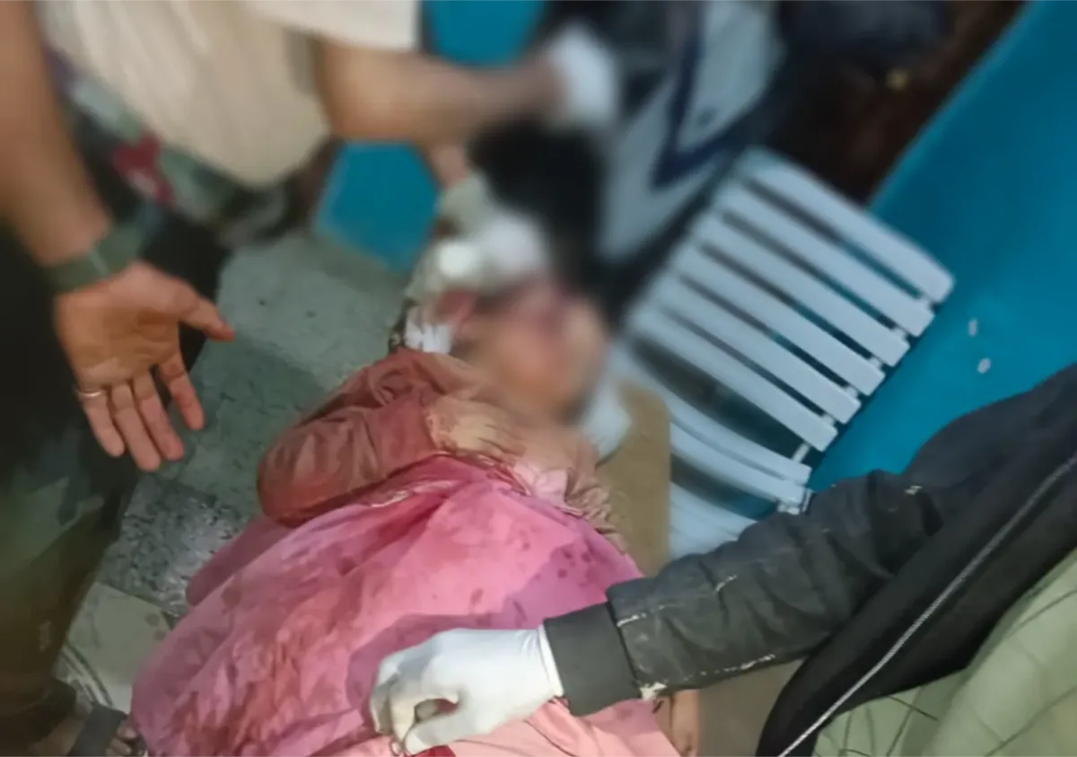 تعز.. استشهاد مدني وإصابة طفلة وامرأة جراء قنص وقصف حوثي في صبر الموادم